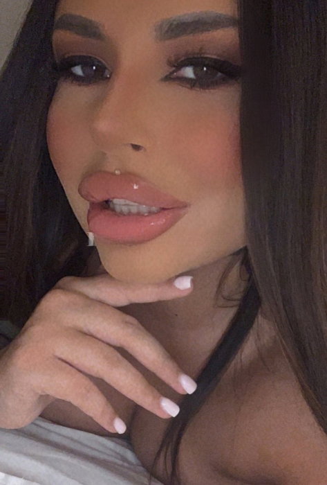 Andra - foto 4